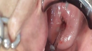 Cervix Play Fucking Deep Japanese Asian style